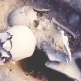 У Греції знайдено воїна з відновленою щелепою за методом Гіппократа
