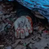 Обстріл Вінницької області – кількість постраждалих зросла до 18