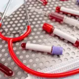 Названы 4 неочевидных причины высокого холестерина
