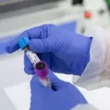 За оцінками ВООЗ до 2050 року кількість нових випадків раку у світі збільшиться до 35 млн